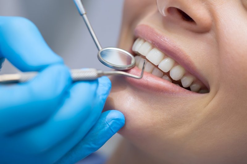 What is Gum Recession