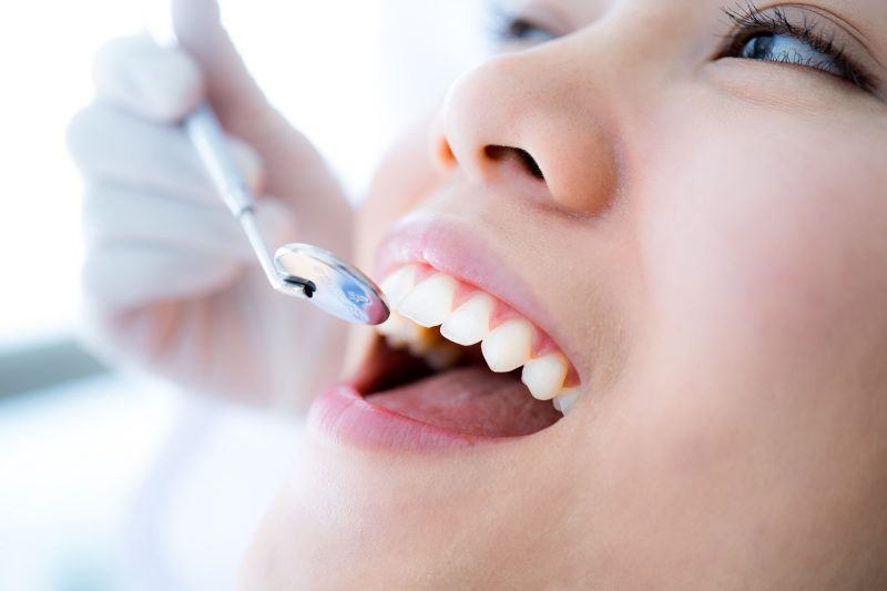 Plaque vs. Tartar Differences and Prevention Tips
